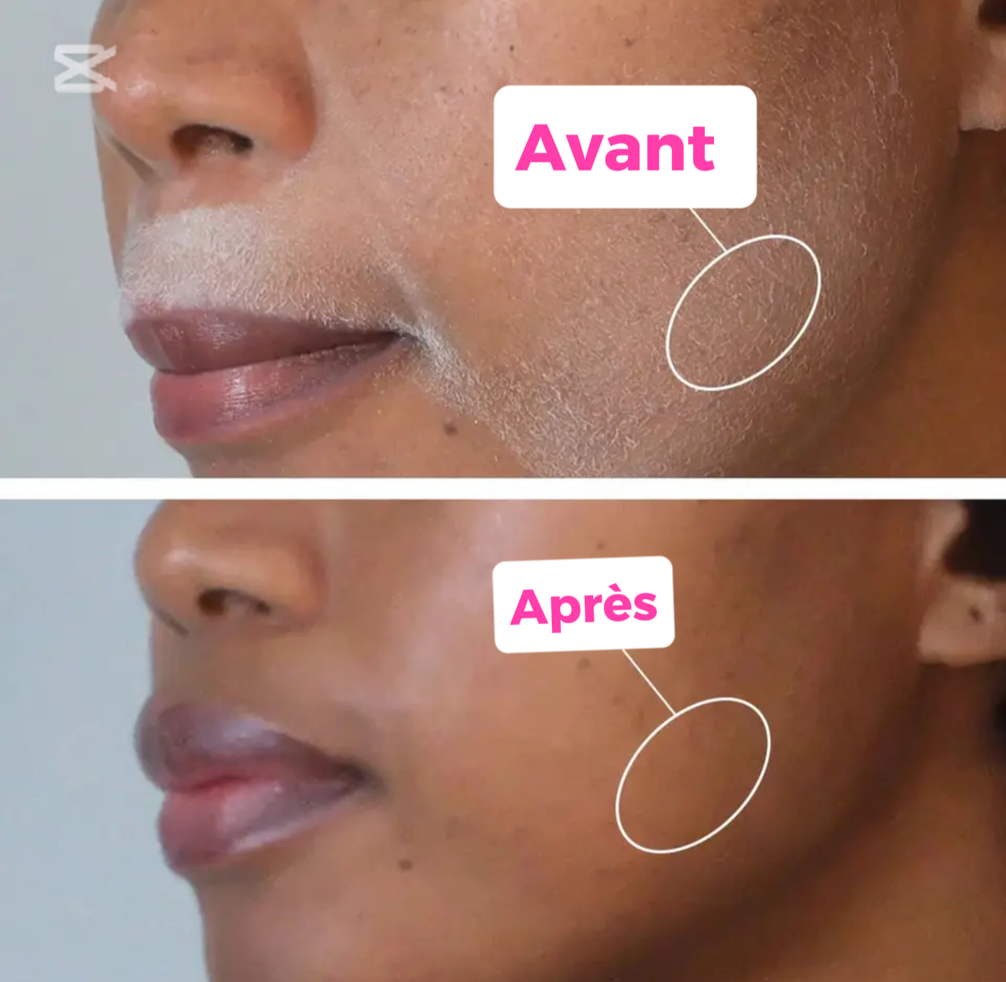 Rasage parfait, peau douce Spray Identifiant Les Cheveux PRÉCIS, SÛR ET PROTECTION POUR LA PEAU